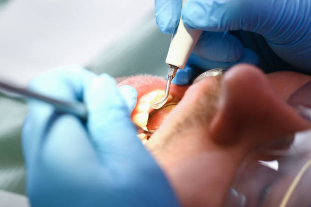 Best Broken or Chipped Tooth Repair in Porter Heights, TX